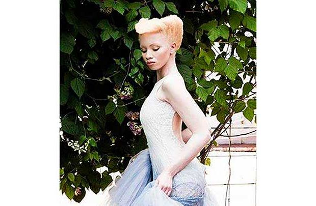 albinismo silvana de mari community